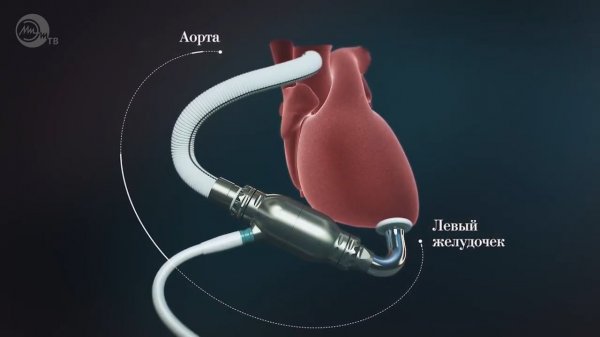 Биотехнические системы и технологии | Направления подготовки МИЭТ