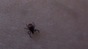 ЭКСПЕРИМЕНТ! Сажаю клеща на себя, куда укусит КЛЕЩ ???