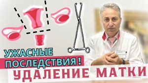 Удалять Матку или Нет в 2025 году ? | Последствия Удаления Матки | Операция при Опущении Матки