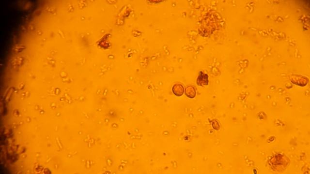 ЛЯМБЛИИ в кале!