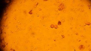 ЛЯМБЛИИ в кале!