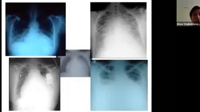 сн смотреть онлайн