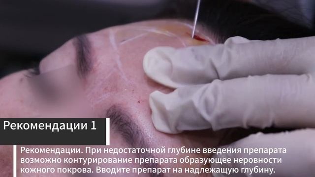 Техника инъекционной мезотерапии зоны лба при помощи филлера Celosome смотреть онлайн
