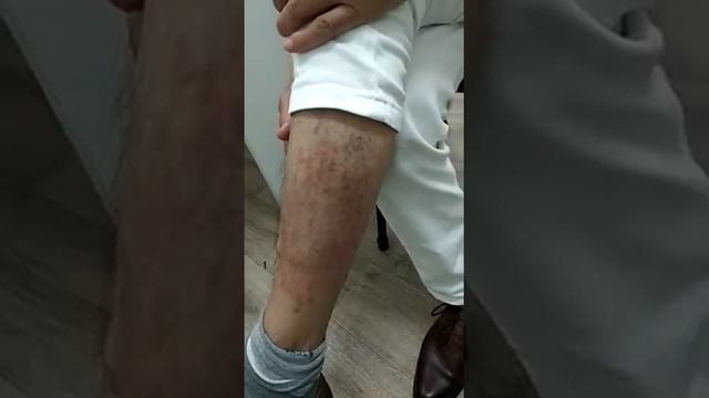 Нео компания. А вот и результат) пишем смотреть онлайн