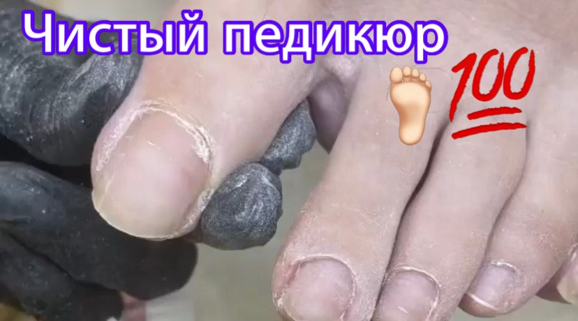 Чистый педикюр ??? смотреть онлайн