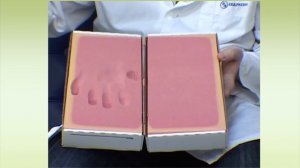 Обувь при синдроме диабетической стопы