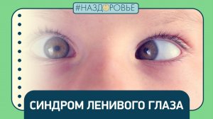 #НАЗДОРОВЬЕ: синдром ленивого глаза