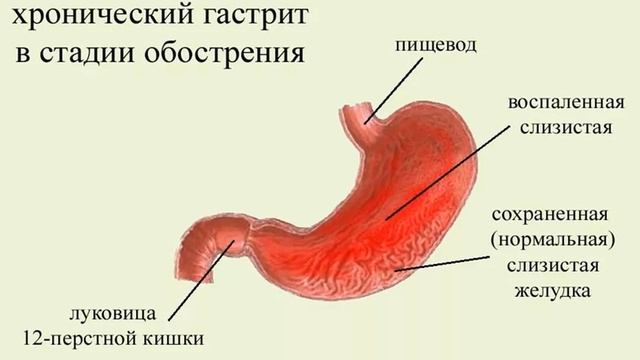 КЕФИР - не польза, а ВРЕД !! смотреть онлайн