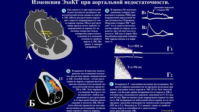 Тема 40. Обследование больных с основными синдромами при патологии сердечно-сосудистой системы. смотреть онлайн