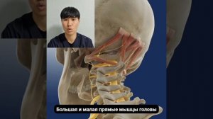 Болит затылок / Анатомия прямых мышц головы #массаж