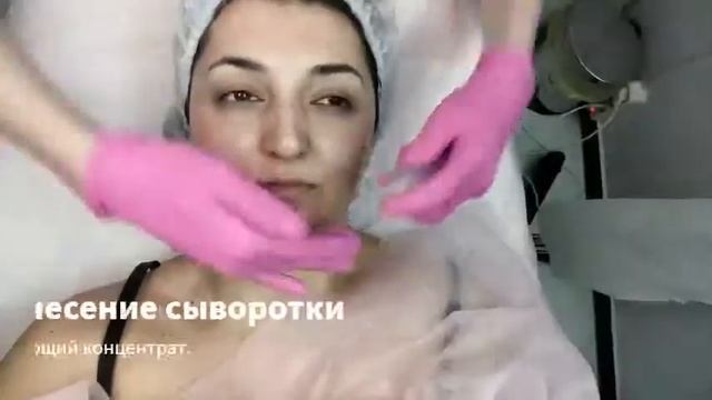 Микродемабразия.Аппарат МИТ 11.Этапы процедуры. смотреть онлайн