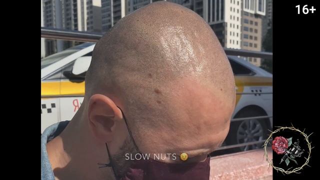 Татуировка волос, сьемка на улице. Скрыть облысение. Трихопигментация. Scalpmicropigmentation. смотреть онлайн