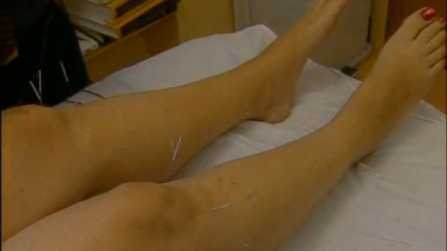 What Happens During An Acupuncture Session?