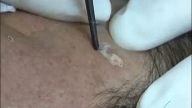 Аппарат ACTIONⅡ смотреть онлайн