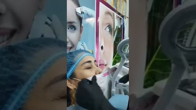 #Нить_иплари_ёрдамида_юзни_ёшартириш смотреть онлайн