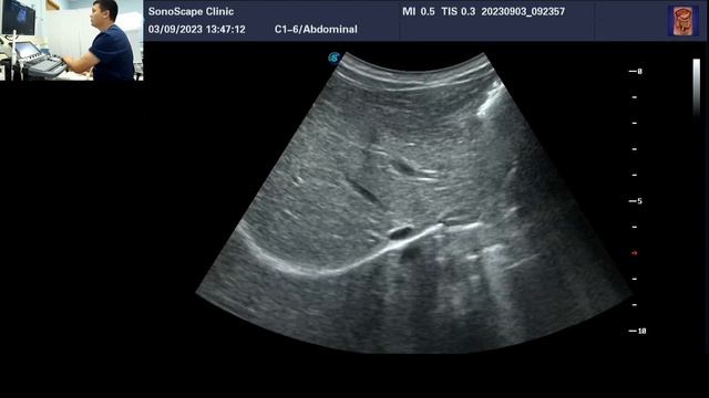 УЗИ ОБП и почек ребенка