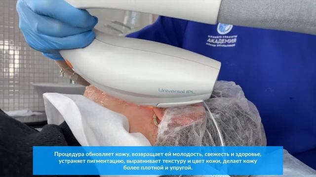 Фотоомоложение на аппарате М22 смотреть онлайн