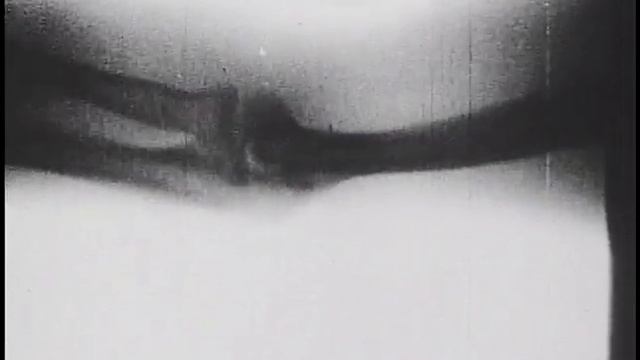 Moving X-Rays (UFA Films, Inc., 1938)