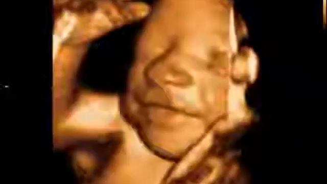 4D узи смотреть онлайн