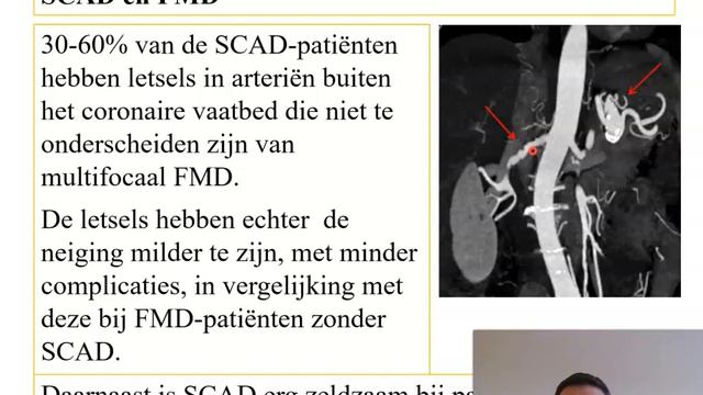 What is FMD? DUTCH Dr Tom Robberechts смотреть онлайн