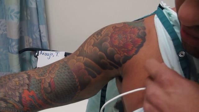 Thiago Pitbull Alves Torn Chest Muscle Surgery 2012 смотреть онлайн
