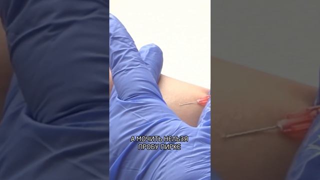 Пробу Манту можно мочить смотреть онлайн