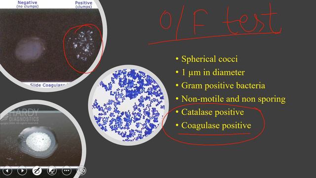 Staphylococcus aureus смотреть онлайн