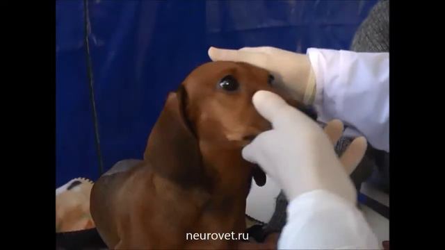 Позиционный страбизм смотреть онлайн