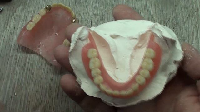 Нижний зубной протез с ушами смотреть онлайн