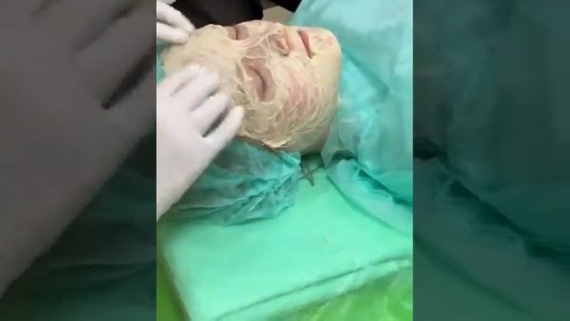 Пилинг энзимный смотреть онлайн