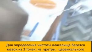 Определение чистоты влагалища