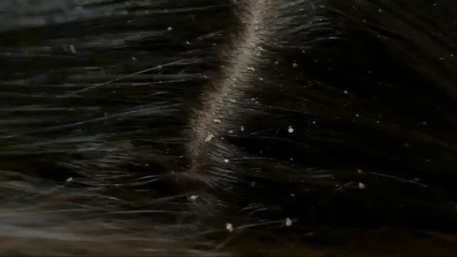 ASMR- Relaxing Scalp Check For Sleep / ZOOM #scratching #asmrsleep #scalp #tweezers