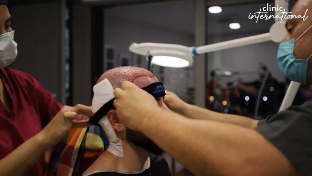 Paul and Florin's Hair Transplant Journey in Turkey I Clinic International смотреть онлайн