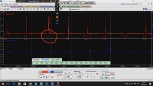Тест работы форсунок датчиком с делителем Diamag 2