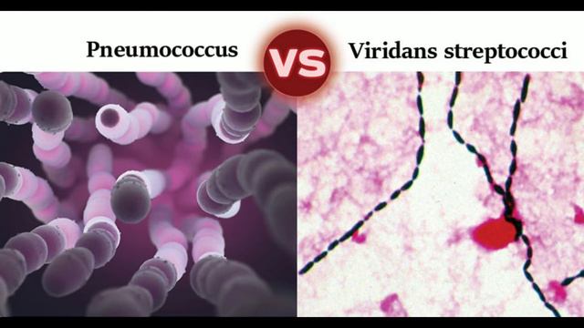 Pneumococcus vs Viridans streptococci 12 Major Differences смотреть онлайн