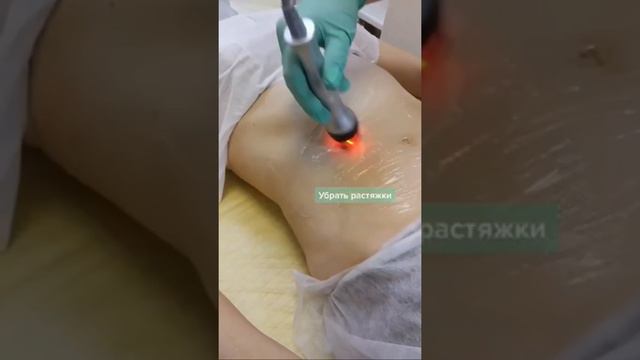 Кавитация смотреть онлайн
