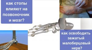 Зажатый малоберцовый нерв не даёт жить стопам, разрушает позвоночник. Упражнения для разблокировки