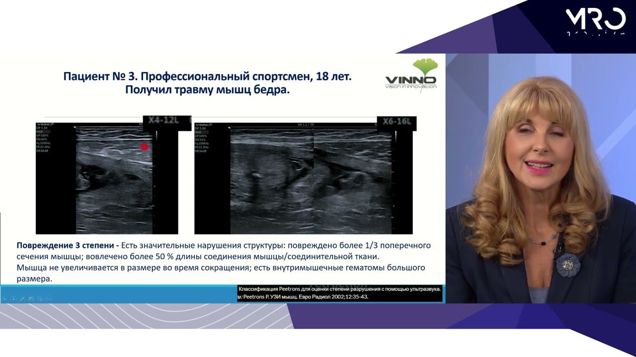 Ультразвуковая диагностика патологии тканей опорно-двигательного аппарата на клинических примерах смотреть онлайн