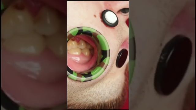У Него Самые Большие Тоннели на Лице!? #shorts #чупачупс #рекорд смотреть онлайн