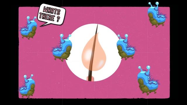 Как образуются прыщи ? смотреть онлайн