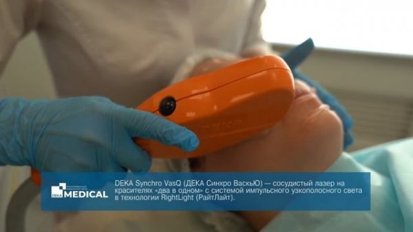 Фотоомоложение | DEKA Synchro VasQ