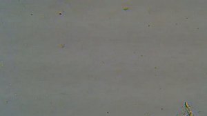 Моча человека под микроскопом. Часть 1.