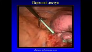 Современная торакальная хирургия, состояние проблемы и перспективы развития