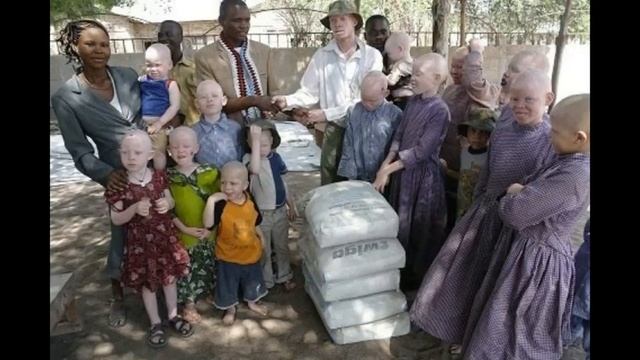 альбиносов в Танзании рубят на куски смотреть онлайн