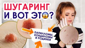 ШУГАРИНГ И ПАПИЛЛОМЫ |  Особенности кожи | Папилломы, кондиломы и родинки – противопоказания?