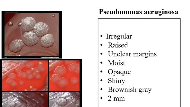 Lab 4 Colony Morphology 2020 MP4 смотреть онлайн