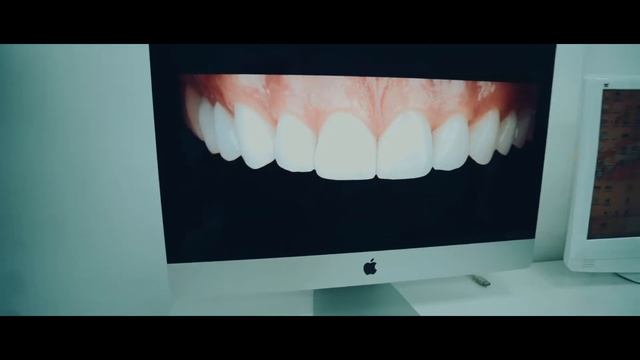 ВИНИРЫ. Создание "Голливудской улыбки" смотреть онлайн