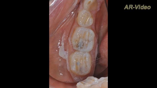 Видео статья. Выполнение Эстетических И Функциональных Требований С Помощью Mock up. смотреть онлайн