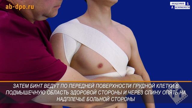 Наложение колосовидной повязки на область плечевого сустава смотреть онлайн