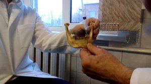 Ментальная анестезия